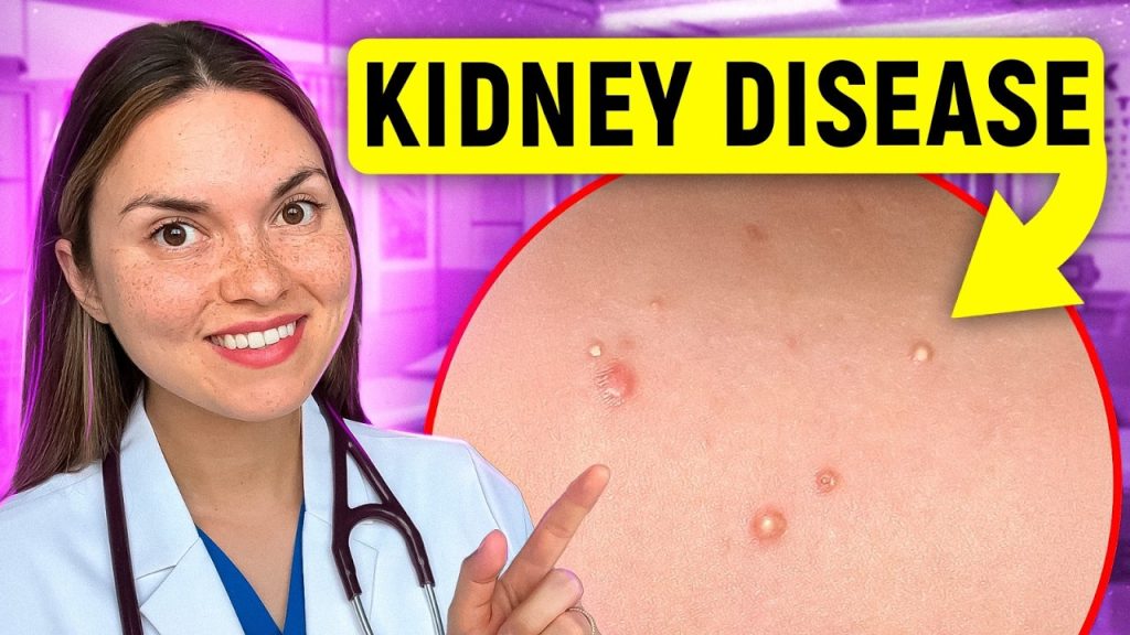 17 Signs of KIDNEY DISEASE You Can See: Doctor Explains 17 Signs of KIDNEY DISEASE You Can See: Doctor Explains