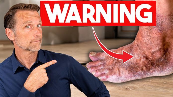 maxresdefault-402 Use Your Feet As Warning Signs